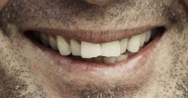 denti